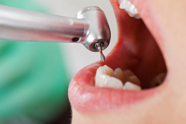 Best Urgent Tooth Repair  in Bagley, MN